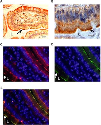 The β2-adrenergic receptor in the apical membrane of intestinal enterocytes senses sugars to stimulate glucose uptake from the gut